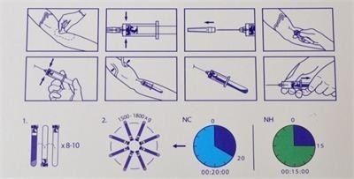 6/8x15ml Dispositivo portátil de centrífuga PRP 0-4000rpm Para hospitais de cirurgia estética
